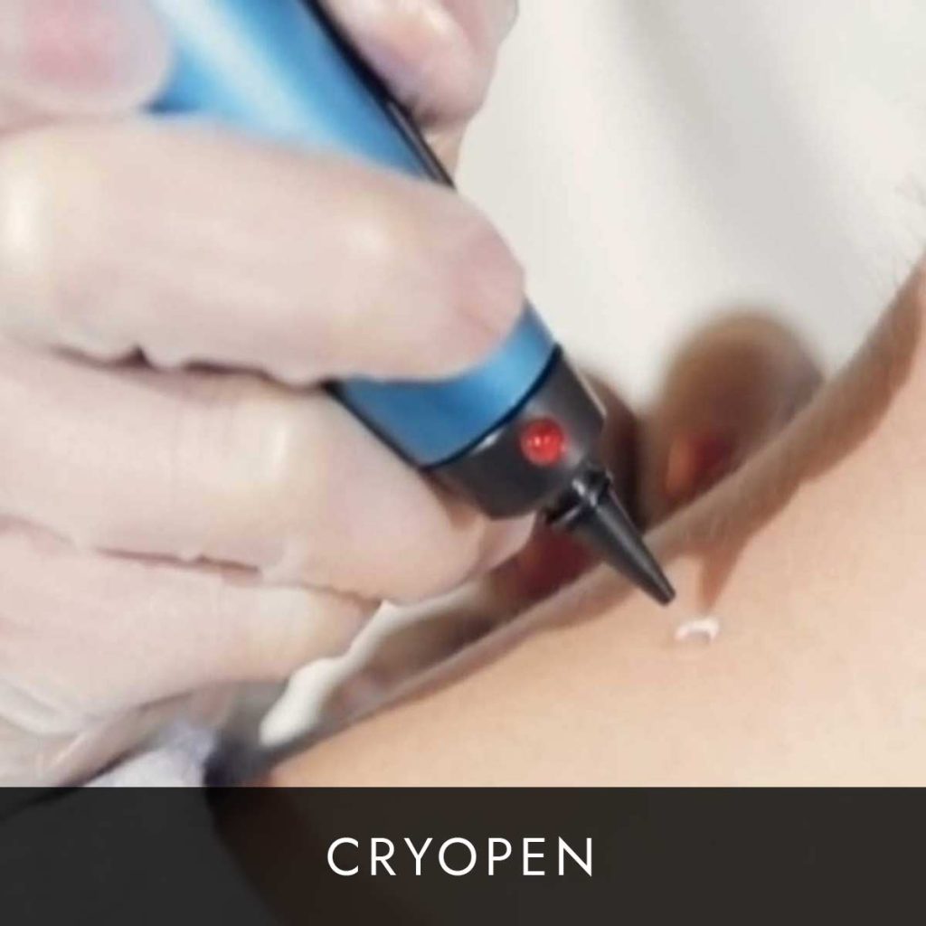 Button-Cryopen