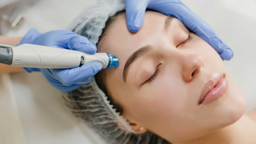 Combining Exosomes with Microneedling