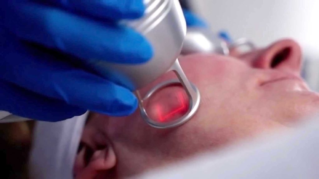 10 Benefits of CO2 Laser Resurfacing